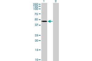 Western Blot analysis of AGK expression in transfected 293T cell line by AGK MaxPab polyclonal antibody. (Acylglycerol Kinase anticorps  (AA 1-422))