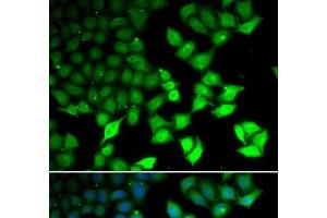 Immunofluorescence analysis of U2OS cells using KDM4B Polyclonal Antibody (KDM4B anticorps)