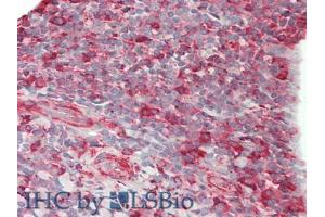 IHC-P analysis of Human Tonsil Tissue, with HE staining. (CD86 anticorps  (AA 46-282))