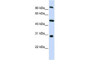 WB Suggested Anti-EML1 Antibody Titration: 0. (EML1 anticorps  (C-Term))