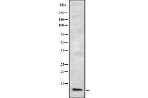 Western blot analysis of MIP-1 alpha using K562 whole cell lysates (CCL3 anticorps  (Internal Region))