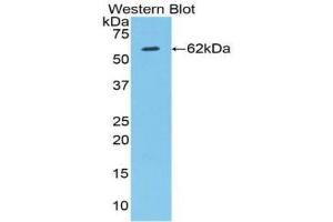 Western blot analysis of the recombinant protein.