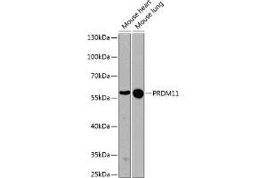 Western blot analysis of extracts of various cell lines, using PRDM11 antibody (ABIN6128494, ABIN6146129, ABIN6146131 and ABIN6224586) at 1:1000 dilution. (PRDM11 anticorps  (AA 228-477))