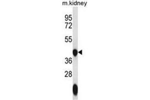 Western blot analysis of GTPBP10 Antibody (C-term) in mouse kidney tissue lysates (35ug/lane). (GTPBP10 anticorps  (C-Term))