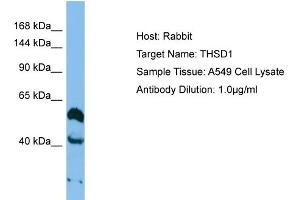 Host: Rabbit Target Name: THSD1 Sample Type: A549 Whole cell lysates Antibody Dilution: 1. (THSD1 anticorps  (Middle Region))
