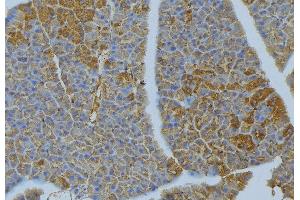 ABIN6277029 at 1/100 staining Human pancreas tissue by IHC-P. (CD70 anticorps  (Internal Region))