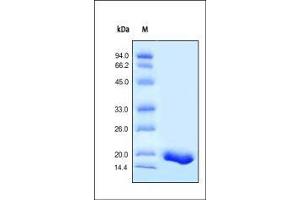 Human TNF-alpha (HPLC-verified) on SDS-PAGE under reducing (R) condition. (TNF alpha Protein (AA 77-233))