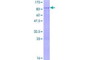 Image no. 1 for Polynucleotide Kinase 3'-Phosphatase (PNKP) (AA 1-521) protein (GST tag) (ABIN1315550)