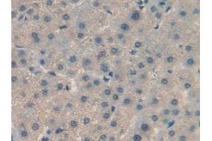 Detection of RBP5 in Human Liver Tissue using Polyclonal Antibody to Retinol Binding Protein 5, Cellular (RBP5)