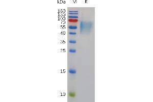 Mouse IL17RA Protein, His Tag on SDS-PAGE under reducing condition.