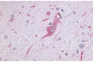 Immunohistochemical (Formalin/PFA-fixed paraffin-embedded sections) staining in human brain, neurons and glia with LPHN1 polyclonal antibody . (Latrophilin 1 anticorps  (Extracellular Domain))