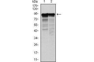 Western blot analysis using NEFL mouse mAb against Hela (1) and Jurkat (2) cell lysate. (NEFL anticorps)