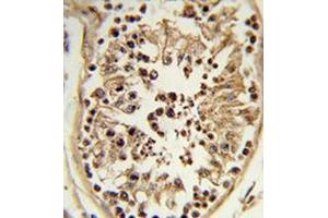 Immunohistochemistry analysis of human testis tissue (formalin-fixed, paraffin-embedded) using Chondroitin sulfate synthase 2  Antibody , which was peroxidase-conjugated to the secondary antibody, followed by DAB staining.