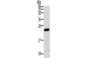 Western Blotting (WB) image for anti-Regulator of G-Protein Signaling 1 (RGS1) antibody (ABIN2424069)