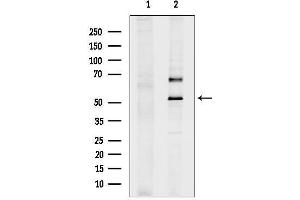 Western blot analysis of lysates from Hela cells, using UMPS Antibody.