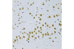 Immunohistochemistry of paraffin-embedded mouse brain using SNRNP70 antibody.
