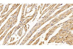 Detection of CAT in Mouse Cardiac Muscle Tissue using Polyclonal Antibody to Catalase (CAT) (Catalase anticorps  (AA 401-523))