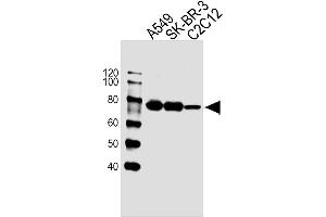 Lane 1: A549 Cell lysates, Lane 2: SK-BR-3 Cell lysates, Lane 3: C2C12 Cell lysates, probed with CAPN2 (1381CT669. (Calpain 2 anticorps)