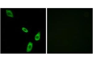 Immunofluorescence analysis of LOVO cells, using ADRA1B Antibody. (ADRA1B anticorps  (AA 431-480))