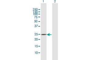 Western Blot analysis of AGPAT2 expression in transfected 293T cell line by AGPAT2 MaxPab polyclonal antibody.