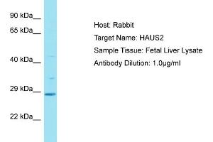 Host: Rabbit Target Name: HAUS2 Sample Tissue: Human Fetal Liver Antibody Dilution: 1ug/ml (HAUS2 anticorps  (C-Term))