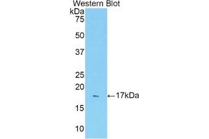 Western blot analysis of recombinant Rat IL1R1. (IL1R1 anticorps  (AA 226-352))