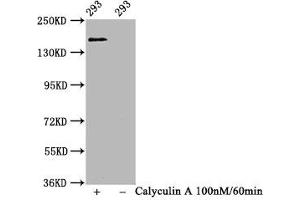 Western Blot Positive WB detected in 293 whole cell lysate(treated with Calyculin A or not) All lanes Phospho-SMC1A antibody at 1. (Recombinant SMC1A anticorps  (pSer957))