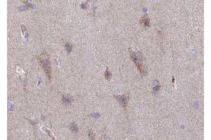 ABIN6267635 at 1/100 staining human brain tissue sections by IHC-P. (GRIN2B anticorps  (pTyr1336))