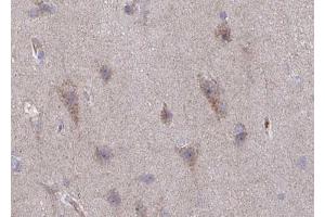 ABIN6267635 at 1/100 staining human brain tissue sections by IHC-P.