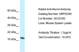 Western Blotting (WB) image for anti-MORN Repeat Containing 4 (MORN4) (C-Term) antibody (ABIN2785367)