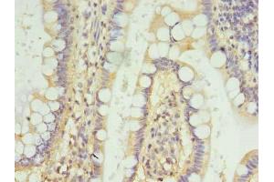 Immunohistochemistry of paraffin-embedded human small intestine tissue using ABIN7152903 at dilution of 1:100 (FSCB anticorps  (AA 1-200))