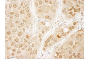 Immunohistochemistry (IHC) image for anti-V-Akt Murine Thymoma Viral Oncogene Homolog 1 (AKT1) (AA 25-75) antibody (ABIN7448406) (AKT1 anticorps  (AA 25-75))