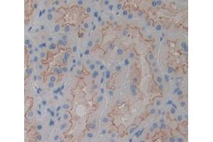 Used in DAB staining on fromalin fixed paraffin- embedded kidney tissue
