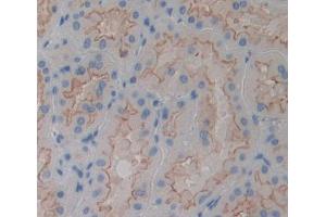 Used in DAB staining on fromalin fixed paraffin- embedded kidney tissue (PTPMT1 anticorps  (AA 71-197))
