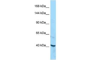 Western Blotting (WB) image for anti-Receptor Tyrosine Kinase-Like Orphan Receptor 1 (ROR1) (C-Term) antibody (ABIN2789668) (ROR1 anticorps  (C-Term))