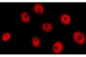 ABIN6274287 staining RAW264. (CEBPG anticorps  (Internal Region))