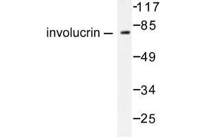 Image no. 1 for anti-Involucrin (IVL) antibody (ABIN265482) (Involucrin anticorps)