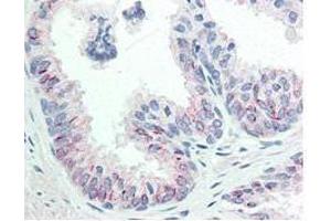 Immunohistochemistry of Mouse anti-AKT pS473 antibody.