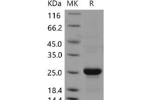Western Blotting (WB) image for C-Type Lectin Domain Family 3, Member B (CLEC3B) protein (His tag) (ABIN7320183) (CLEC3B Protein (His tag))
