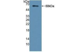 Detection of Recombinant CAP2, Human using Polyclonal Antibody to Adenylyl Cyclase Associated Protein 2 (CAP2)