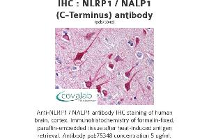 Image no. 1 for anti-NLR Family, Pyrin Domain Containing 1 (NLRP1) antibody (ABIN1737385) (NLRP1 anticorps)