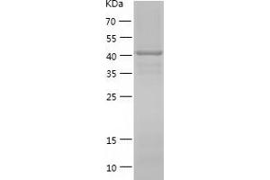 Western Blotting (WB) image for Cytohesin 3 (CYTH3) (AA 1-399) protein (His tag) (ABIN7122588) (Cytohesin 3 Protein (CYTH3) (AA 1-399) (His tag))