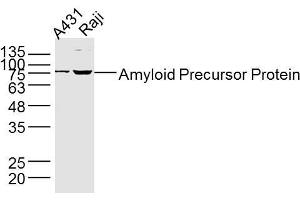 Lane 1: A431 lysates Lane 2: Raji lysates Jurkat lysates probed with Amyloid Precursor Protein Antibody, Unconjugated  at 1:300 dilution and 4˚C overnight incubation. (APP anticorps  (AA 381-480))