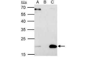 IP Image Sorcin antibody [N1C3] immunoprecipitates Sorcin protein in IP experiments. (SRI anticorps)