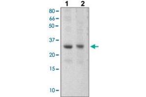 The tissue lysates derived from mouse liver (Lane 1), mouse muscle (Lane 2) were immunoprobed by SOCS3 polyclonal antibody  at 1 : 500. (SOCS3 anticorps  (C-Term))