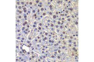 Immunohistochemistry of paraffin-embedded mouse liver using FUBP3 antibody at dilution of 1:100 (40x lens). (FUBP3 anticorps)