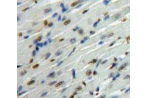 Used in DAB staining on fromalin fixed paraffin-embedded Heart tissue (SMAD6 anticorps  (AA 261-495))