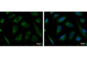 ICC/IF Image PRKCSH antibody detects PRKCSH protein at endoplasmic reticulum by immunofluorescent analysis. (PRKCSH anticorps)
