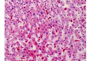 Human Liver: Formalin-Fixed, Paraffin-Embedded (FFPE)