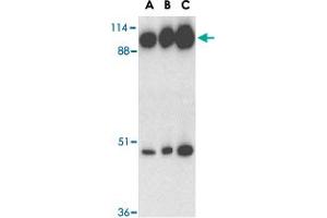 Western blot analysis of ACE2 in human kidney tissue lysate with ACE2 polyclonal antibody  at 0.